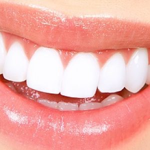 Close relation between teeth colour and many diseases explained!!