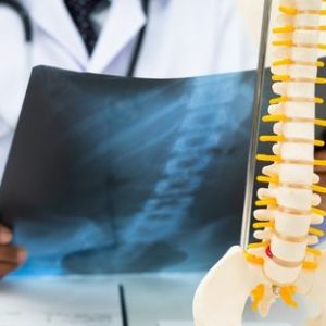 Simple Habits That Can Help Keep Your Bones Strong