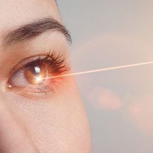 LASIK Eye Surgery: Benefits, Risks, and What to Expect