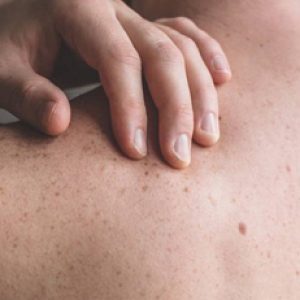 Common reasons why small irritating bumps occur on our backs!!